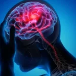 لخته خون در مغز چرا اتفاق می افتد؟