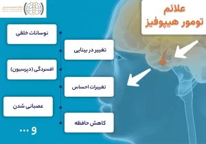 علائم تومور هیپوفیز چیست؟