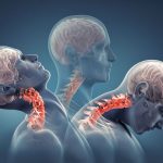 میلوپاتی چیست ؟ هرآنچه باید بدانید