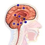 تفاوت بین تومور مغزی اولیه و تومور مغزی متاستاتیک