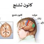 تشنج چیست: علائم و درمان‌
