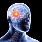 تومور مغزی و افسردگی؛ آیا تغییرات خلقی میتواند هشداری برای وجود تومور مغزی باشد؟