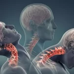 همه چیز درباره‌ی ضربه مغزی؛ بررسی علائم، علت و درمان آن