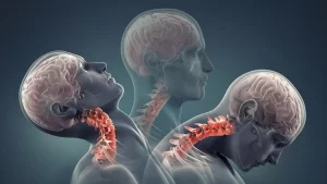 همه چیز دربارهی ضربه مغزی