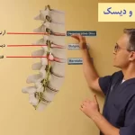 تفاوت آرتروز ستون فقرات و دیسک