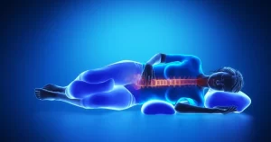 درمان دیسک کمر با استراحت